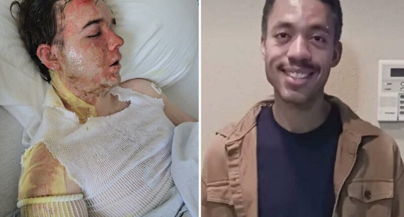 California McDonaldâs manager speaks out after coworker threw oil on him